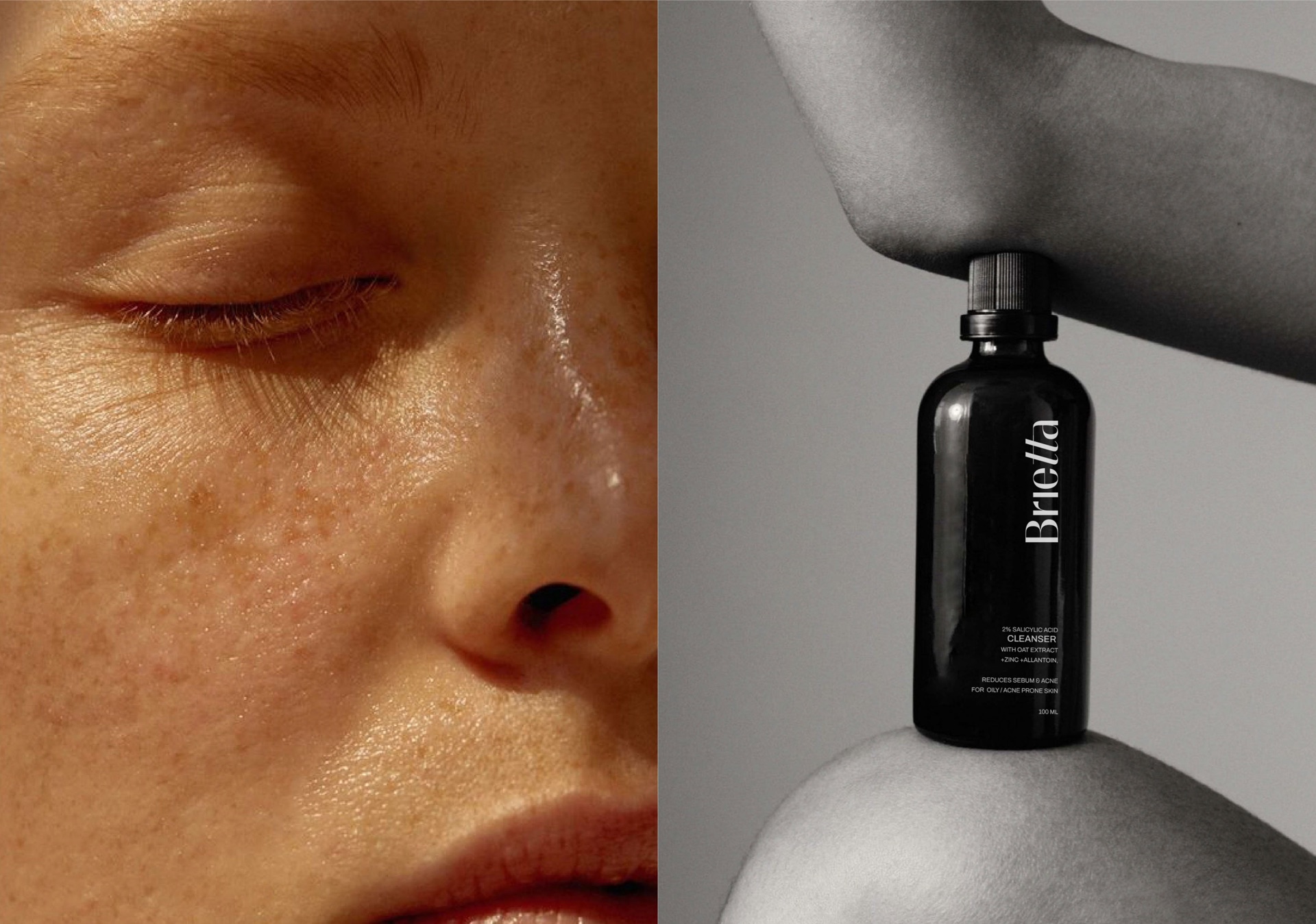 Close up of a freckled face next to a black glass bottle balanced on a shoulder